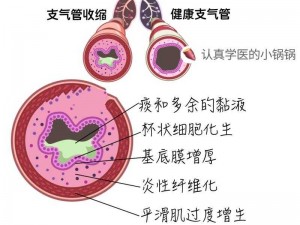 下边一阵一阵收缩，是有炎症吗？