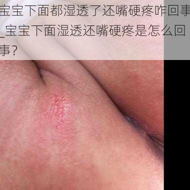 宝宝下面都湿透了还嘴硬疼咋回事_宝宝下面湿透还嘴硬疼是怎么回事？